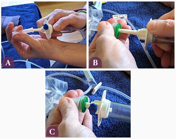 Placing plastic spike in fluid bag