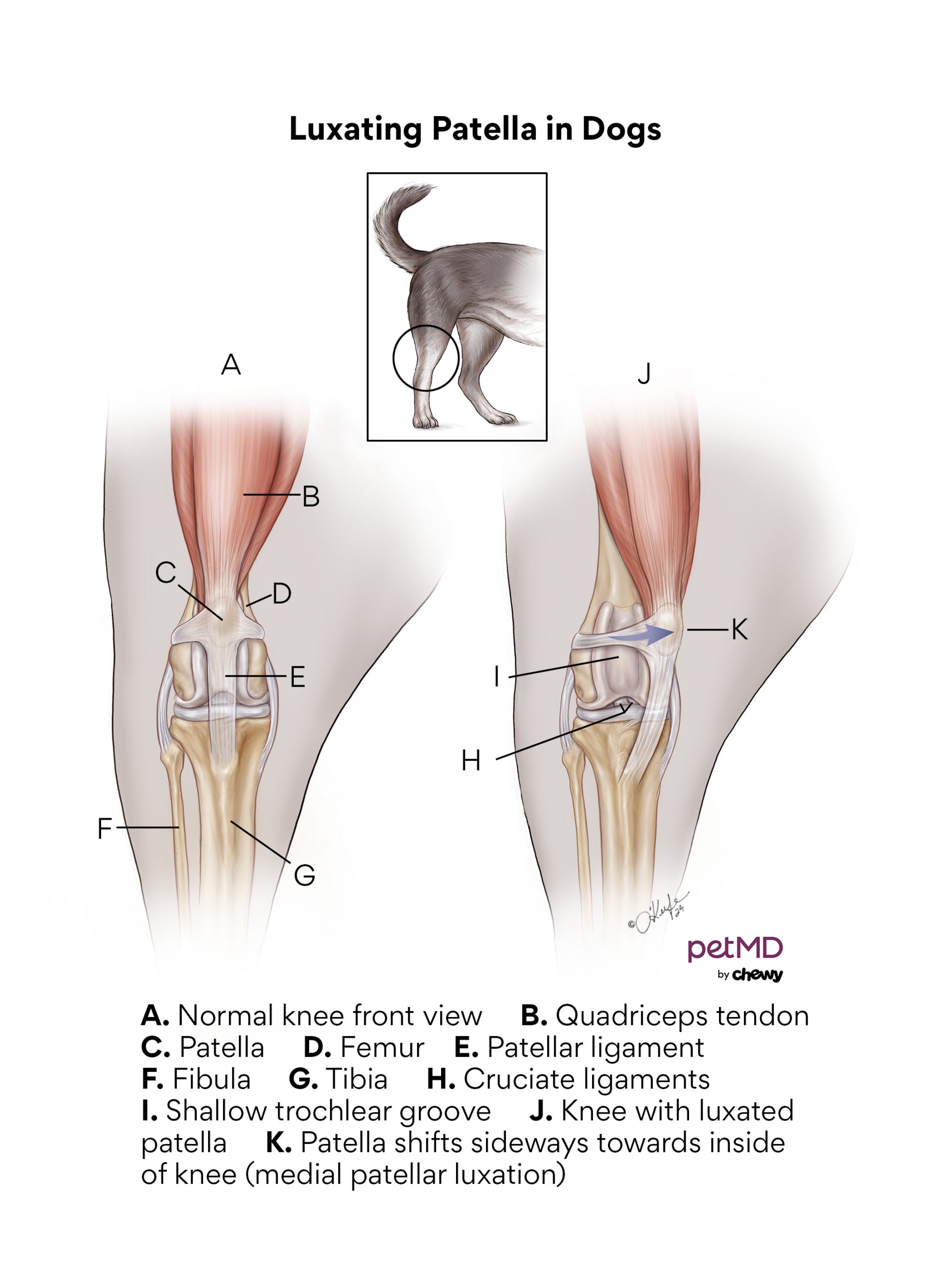 luxating patella in dogs; a diagram showing what a dog's ligaments look like when they have a luxating patella.